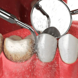 Higiene Bucodental.