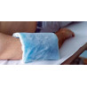 Tratamiento de Crioterapia.