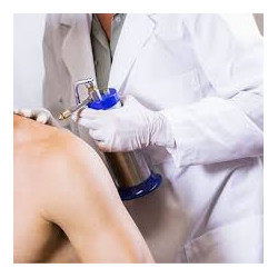 Tratamiento de Crioterapia.