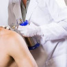 Tratamiento de Crioterapia.